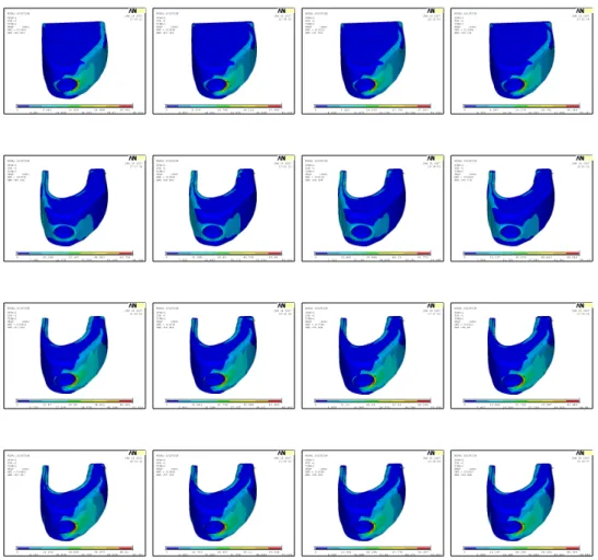 Figure  6.  Distribution  of  stresses  in  all  locations  with  lateral  vertical  loads(outer  cortical : 0.5mm)