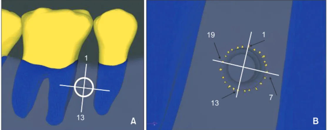 Figure 6. Twenty-four reference nodes of the cortical bone. Reference node 1 is at the most occlusal direction