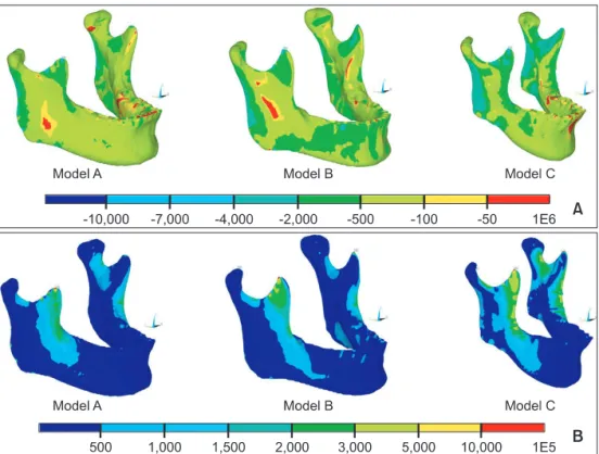 Figure 8. Comparison of the strain distribution of the mandible under clenching in 3 models