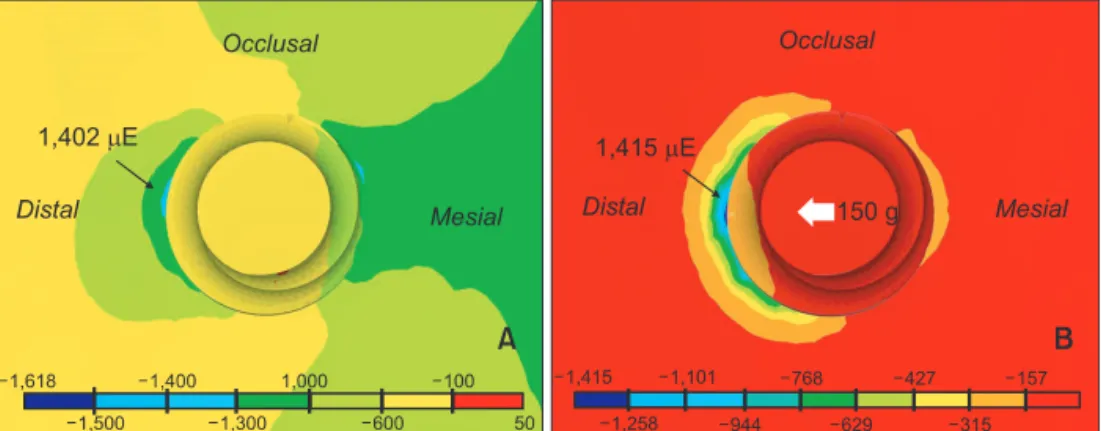 Figure 10. Comparison of peri-orthodontic mini-implant compressive strain with a contour plot in model
