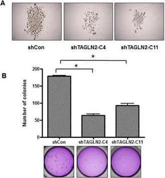 Figure 2. Effect of TAGLN2 suppression on self-renewal and clonogenic  capacities of SNU-1196 cells