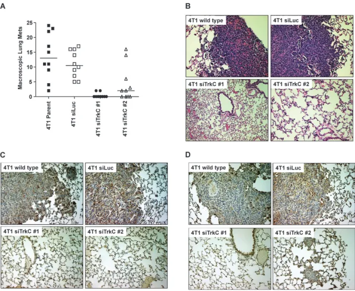 Fig. 5. Suppression of TrkC expression inhibits metastasis of 4T1 cells to the lung. (A) Total numbers of lung metastatic nodules in each mouse of each group were counted under the dissection scope