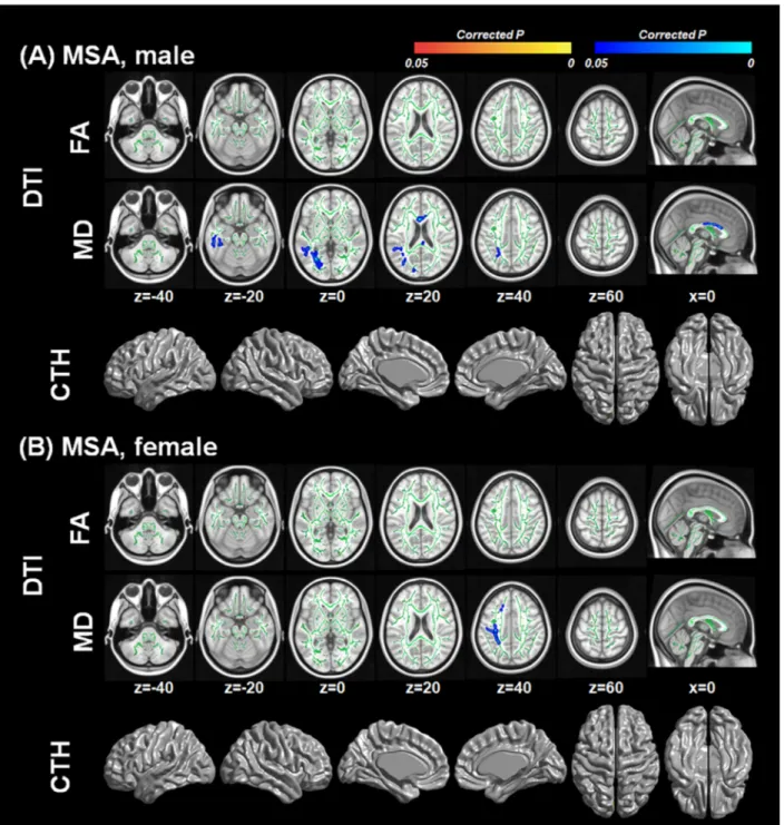 Figure 2. White matter integrity and cortical thickness associated with serum urate levels according to sex