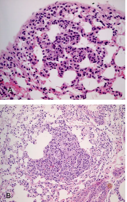 Fig.  2.  Alveolar  hyperplasia  developed  in  the  mouse  lung  tissue  at  6  weeks  and  9  weeks  after  urethane  administration