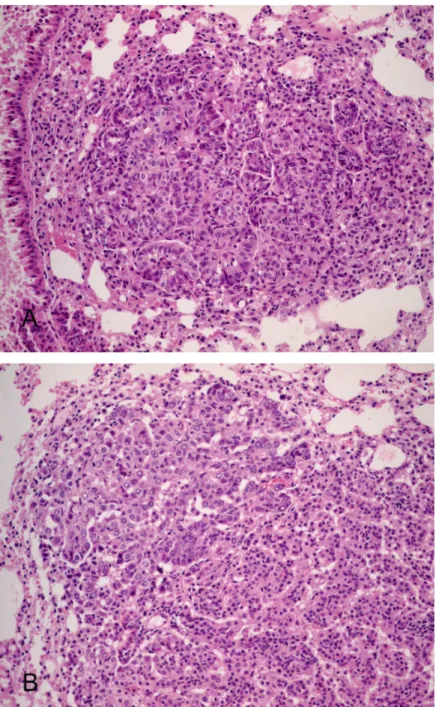 Fig.  3.  Atypical  adenomatous  hyperplasia  developed  in  the  mouse  lung  tissue  at  12  weeks  and  28  weeks  after  urethane  administration