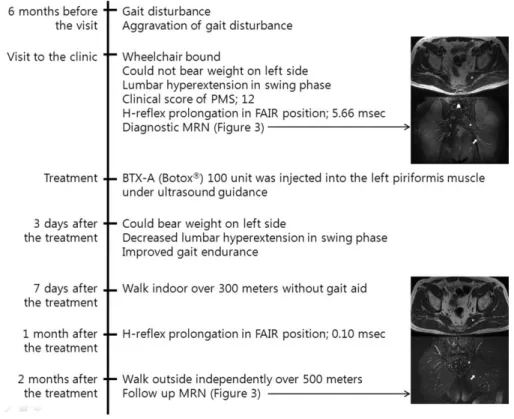 FIGURE 4. Timeline of Case 2.