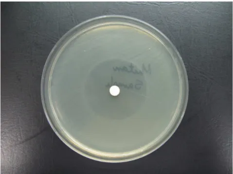 Figure  3.  Antimicrobial  activity  of  Hamamelis  virginiana  extracts  aganist  Klebsiella  pneumoniae