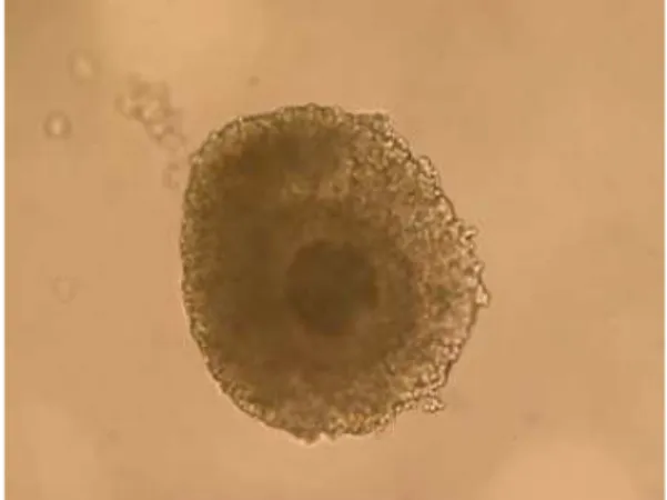 Fig.  1.  An  immature  cumulus  oocyte  complex  (COC)  (10×  objective).