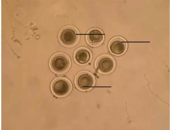 Fig.  3.  Mature  oocytes  with  polar  body.  Black  arrow  indicates  polar  body  (10×  objective).