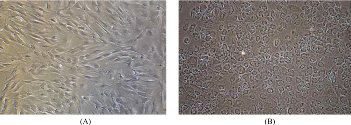 Fig.  2.  Morphological  changes  in  α-1,3-galactosyltransferase  knockout  pig-derived  bone  marrow-derived  mesenchymal  stromal  cells  trans-  fected  with  the  hPDX1  gene