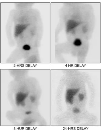 Fig.  1.  Abdominal  sonography  shows  normal  appearance  of  gallbladder,  and  no  evidence  of  bile  duct  dilatation
