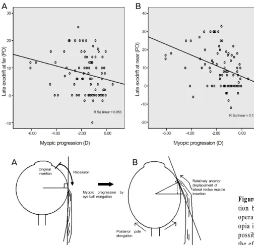 Figure 1. Correlation between late  exodrift (EOM final  - EOM 6weeks ) and 