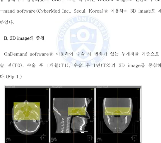 Figure  1. Superimposition  of  3D  CBCT  images  using  cranial  base  structures in  OnDemand  software