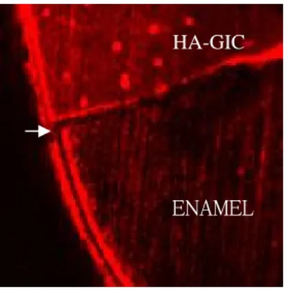 Fig. 7. Sectioned surface of the interface between tooth and material  under confocal laser scanning microscope(CLSM) after  demineralization (x 10)