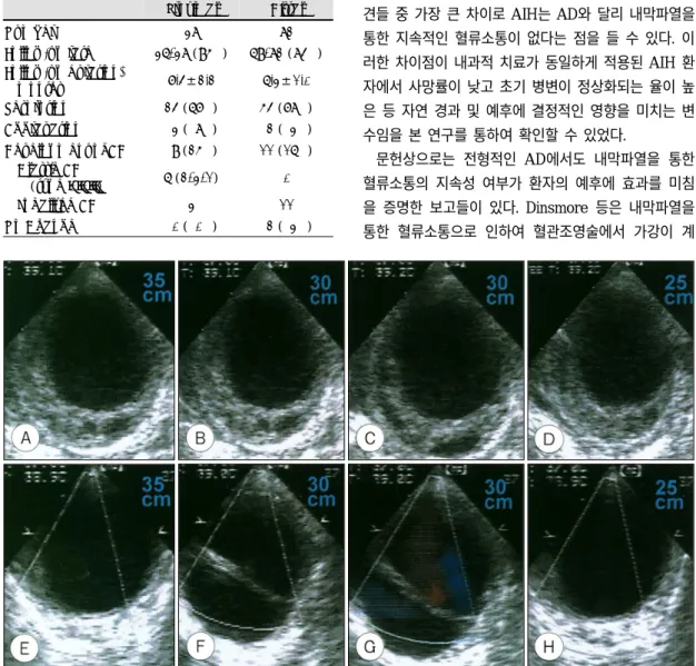 Fig. 5. An example of development of localized aortic dissection in aortic intramural hematoma with medical tr- tr-eatment