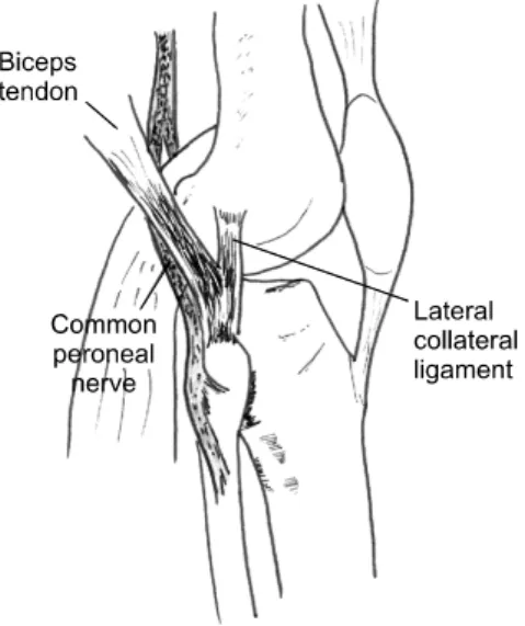 Fig. 4. Descriptive classification system of knee joint dislo- dislo-cation. (A) Posterior
