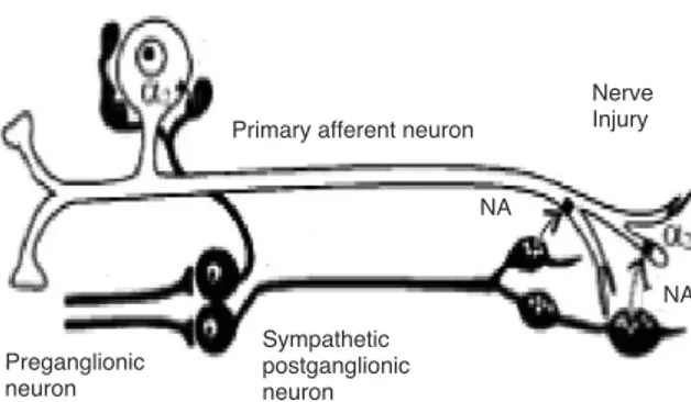 Figure 1. Coupling between primary afferent neuron and sympa- sympa-thetic neuron after nerve injury (NA, noradrenalin).