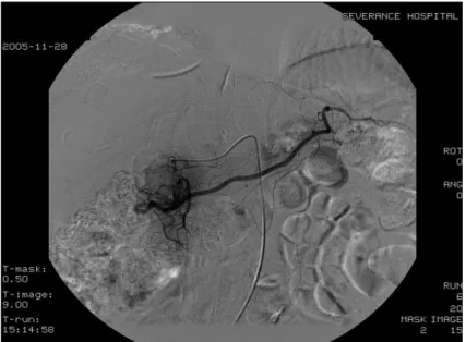 Fig.  3.  Celiac  angiography  shows  normal  findings.