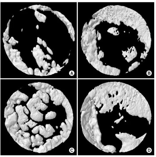 Table 1. Microscopic computerized tomography analysis Variable  4 weeks 8 weeks Control  (unfilled) Experimental 