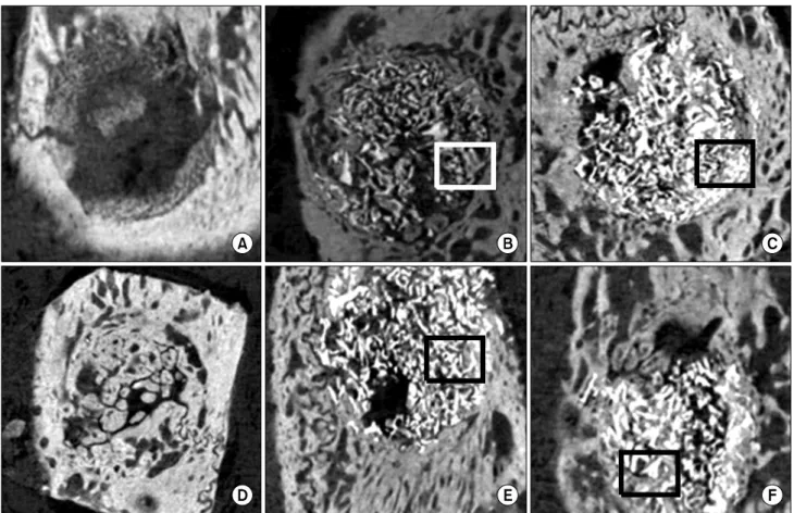 Fig. 1. Representative micro computed tomography images of the bone graft groups. New bone formation was excellent in the experiment 1 group (B, E) and experiment 2 group (C, F) rather than in the control group (A, D) at 6, 12 weeks