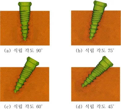 Fig 2. 3-dimensional finite element model of mini screw, cortical bone and   cancellous bone   2