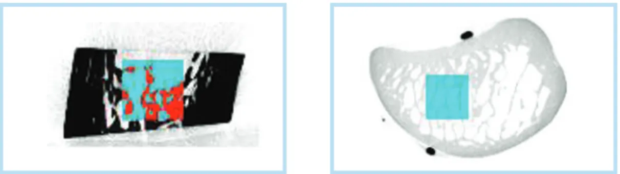 그림 2.  Region of interest (ROI) in each specimen : 3.20×3.20 ㎟