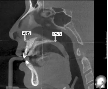 Fig. 2. Windows of EZ3D program Plus Professional ver. (Vatech, Hwaseong, Korea), coronal views