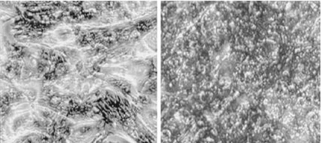 Fig. 2. Microscopic findings of alkaline phosphatase staining of mesenchymal stem cell cultured in control medium