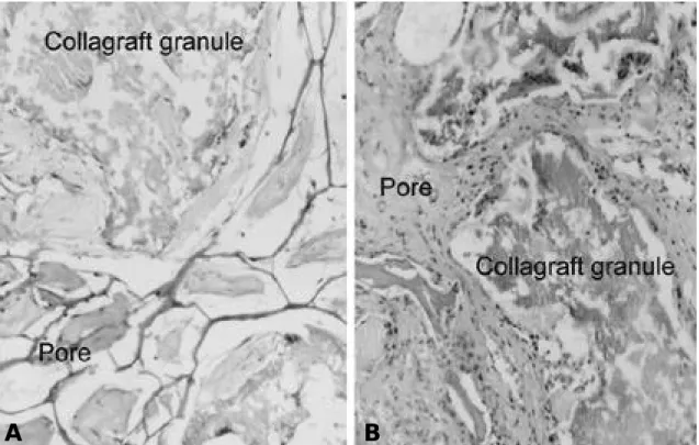 Fig. 5. A. Microscopic findings of H-E stained specimen (collagraft only), which was grafted on the back of rat 6