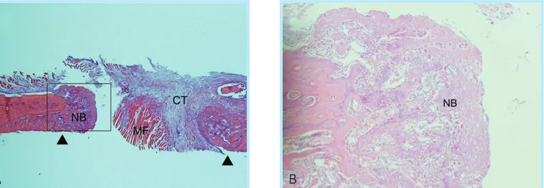 Fig. 7.  Representative photomicrographs of mandibular defects receiving the bovine collagen matrix at 2 weeks (B; boxed area in A)