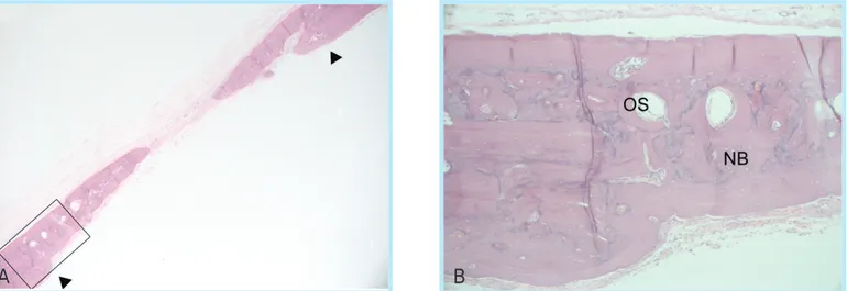Fig. 8.  Representative photomicrograph of calvarial defects receiving the bovine collagen matrix at 8 weeks (B; boxed area in A)