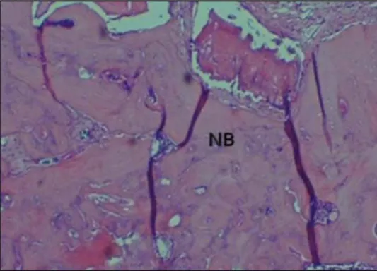 Figure 16. rhBMP-2/Bio-Oss® 8weeks (×100, HE)