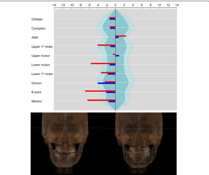 Fig. 7 Case 2. The asymmetry index on U6 and U1 was improved by canting correction and midline correction of the maxilla