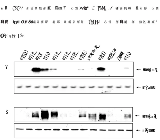 Fig. 2. IGFBP-3 expression in NSCLC cell lines. The expression of IGFBP-3 in a panel of NSCLC cell lines was examined by A, Northern blot analysis