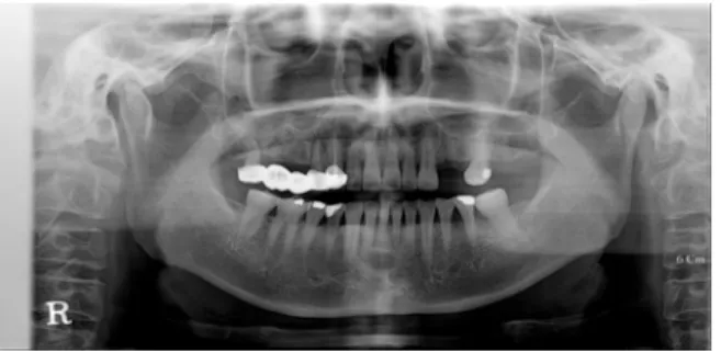 Fig.  2.  치근단  방사선  사진  소견  (Periapical  radiographic  image) 