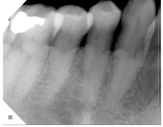 Fig.  5.  파노라마  방사선  사진  소견 (Panoramic  radiographic  image)