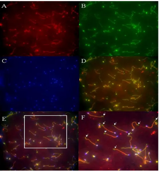 그림  5.  정상군의  정자에서  CatSper와  β-tubulin에  대한  형광  면역세포화학법  결 과.  A.  CatSper  단백질  면역반응이  정자의  미부에서  관찰되었다  (적색형광)