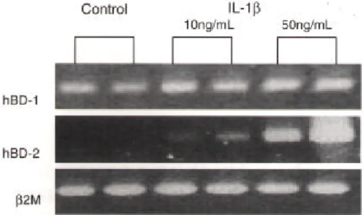 그림 6. 배양된 정상 중이상피 세포주에서 TNF-α 로 자극 후 hBD-1 과 2 mRNA의 발현. 10, 50 ng/ml 농도의 TNF-α 로 자극한 경우 hBD-2 mRNA는 현저히 증가된 발현을 보였으며, 이는 농도에 비례 하여 지속적으로 증가되었다