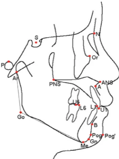 Figure 2. Cephalometric landmarks. 