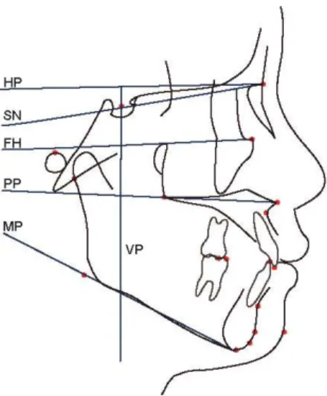 Figure 3. Cephalometric reference planes 