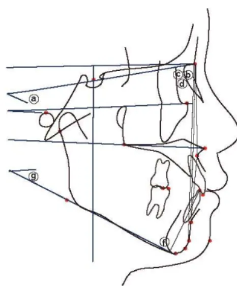 Figure 5. Skeletal angular measurements 