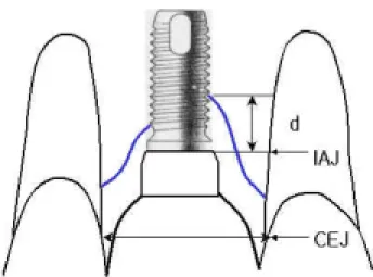 Figure  1.  Schematic  drawing  for  the  amount  of  marginal  bone  loss 