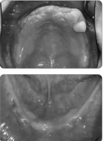 Fig. 1. Panoramic radiographic view and intraoral view in  patient at initial visit.