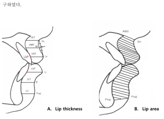 Fig. 2 Measurements of lip thickness (A) and lip area (B).   