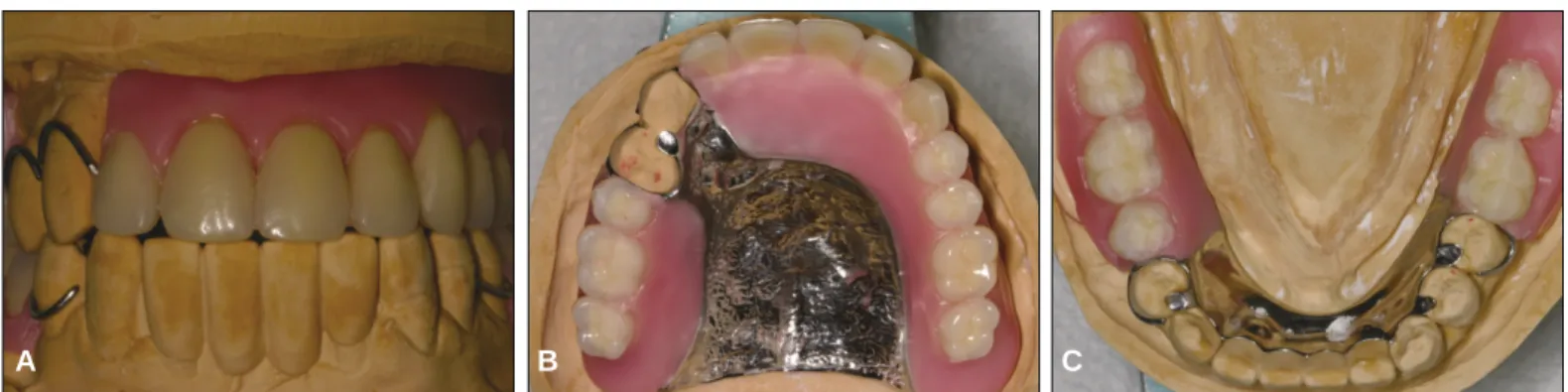Fig. 6. Periapical radiograph 3 months after delivery.