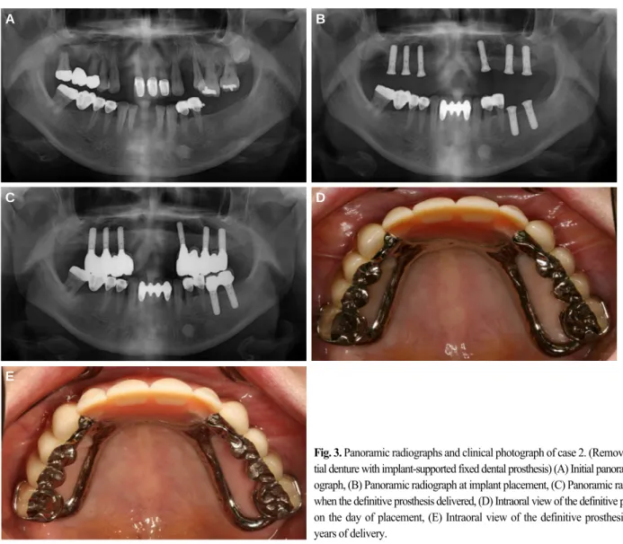 Fig. 3. Panoramic radiographs and clinical photograph of case 2. (Removable par-