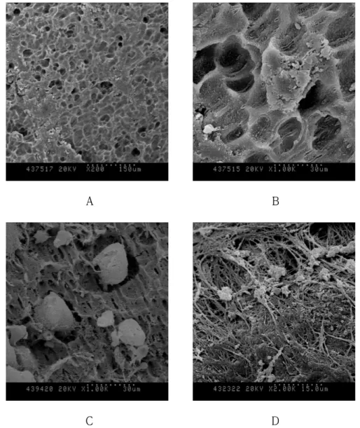 Fig. 2. Scanning electron micrographs of pathologic root resorption surface of  human  deciduous  teeth  due  to  trauma  (A)  Mainly  resorption  took  place  at  one side of the root and resorption fossae were formed at an angle (x200)  (B)  On  high  ma