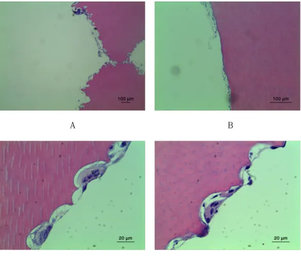 Fig.  4.  Light  micrographs  of  physiologic  root  resorption  surface  of  human  deciduous  teeth  (A)  A  typical  form  of  physiologic  deciduous  root  resorption  progressing from the apex to the cementoenamel junction