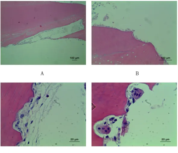 Fig.  5.  Light  micrographs  of  pathologic  root  resorption  surface  of  human  deciduous  teeth  due  to  trauma  (A)  Unilateral  root  resorption  in  progress  was  found  (x40)  (B)  Newly  formed  cementum-like  tissue  over  the  resorption  sur