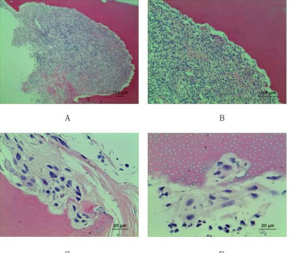 Fig.  6.  Light  micrographs  of  pathologic  root  resorption  surface  of  human  deciduous teeth due to periapical inflammation (A) Resorption pattern did not  seem to typical pattern and resorption fossae appeared in a variety of forms  (x40) (B) Numer